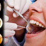 Лунный календарь лечения зубов на август 2020 года благоприятные дни